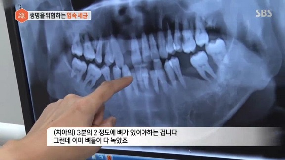 민망한 입냄새.. 양치해도 소용없다면? 구취 없애는 방법