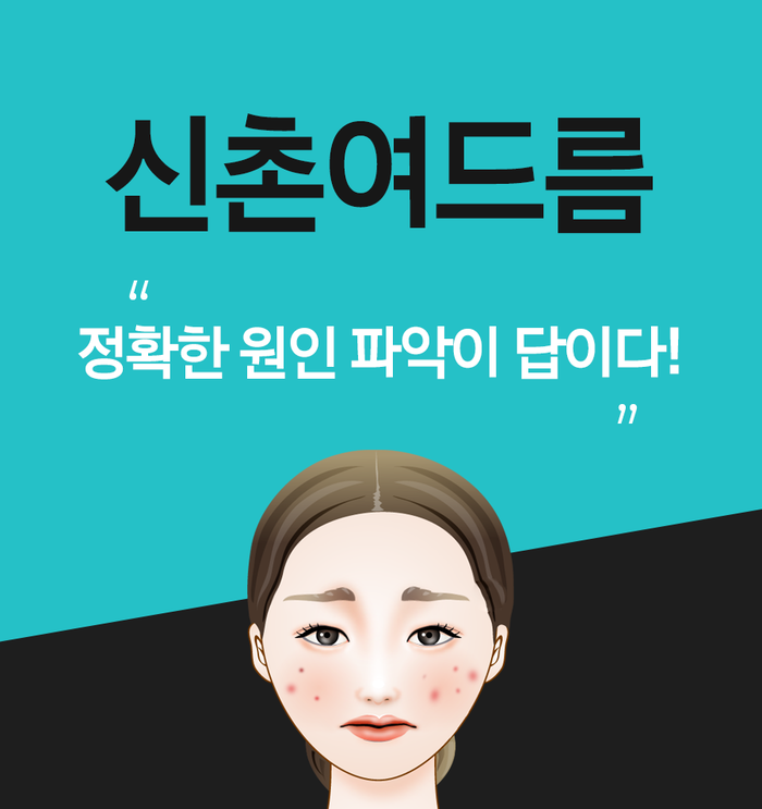 여드름치료, 신촌여드름한의원에서 말하는 일차적 문제란?