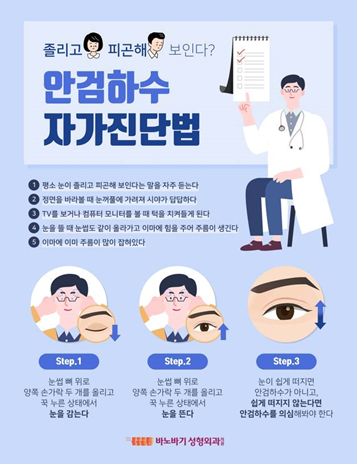 “졸려 보여요” 자꾸 듣는다면 ... 5초 만에 하는 안검하수 자가진단법