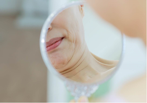 무너진 얼굴 V라인 ... 비절개식·절개식 리프팅 중 선호 따라 선택 가능해
